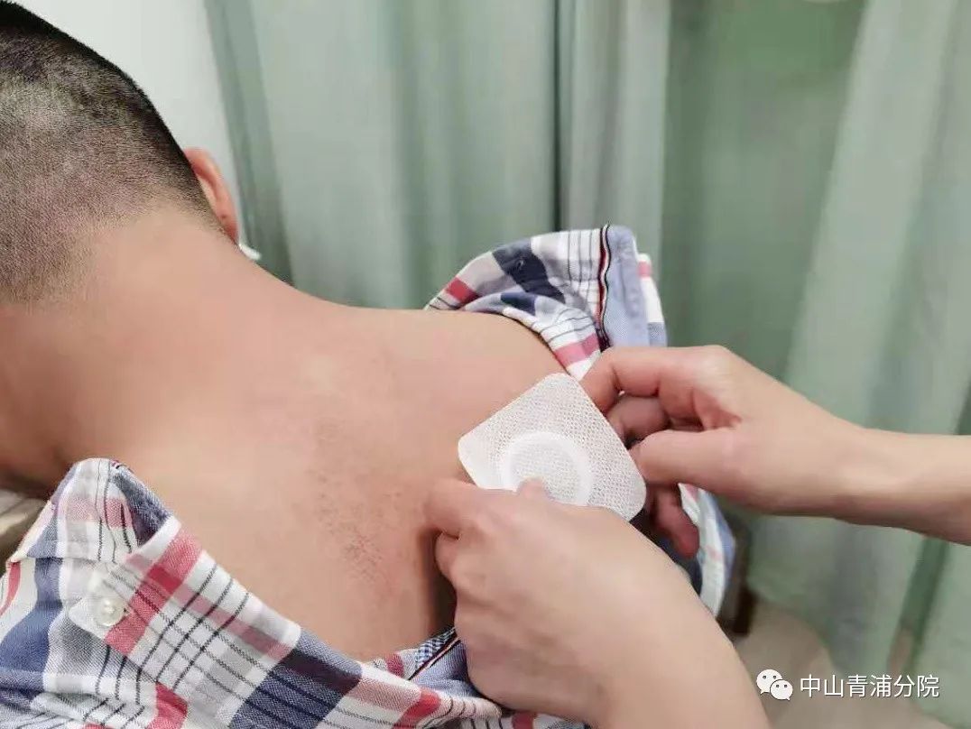 2、江西兒童貼三伏貼癢灼痛，什么體質(zhì)的人可以貼三伏貼癢灼痛？